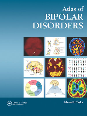 cover image of Atlas of Bipolar Disorders